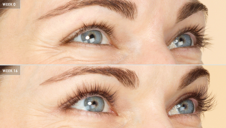 latisse eyelash treatment before after in asheville